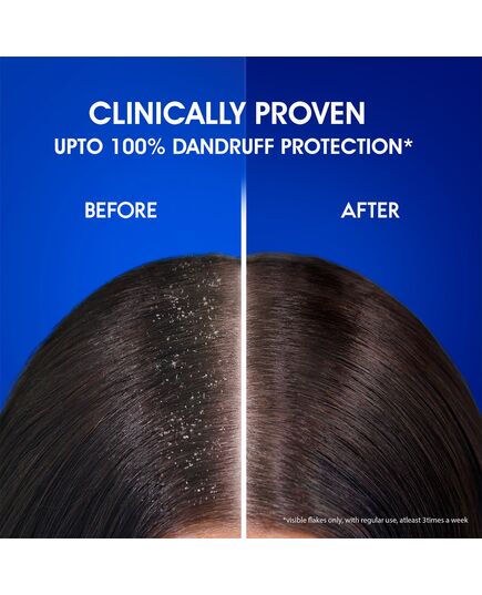 Head & Shoulders Anti-Dandruff Shampoo (Cool Menthol and Energizes Scalp) - 1L