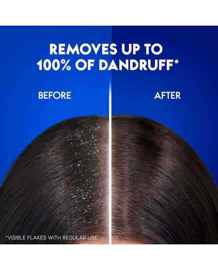 Head & Shoulders Charcoal Detox Anti-Dandruff Shampoo 400 Ml Dual Pack