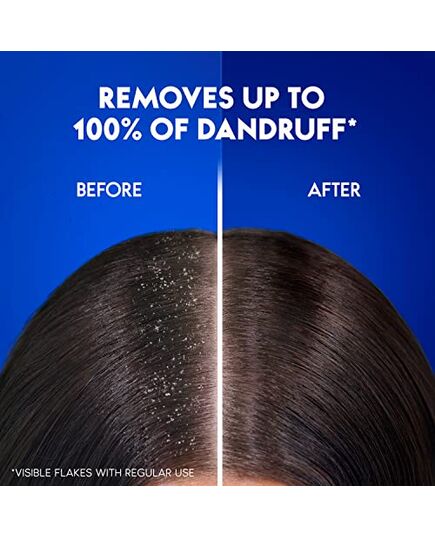 Head & Shoulders Smooth and Silky Anti-Dandruff Shampoo 600 ml + 200 ml