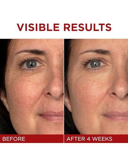 L'OREAL PARIS Skincare Revitalift Triple Power Anti-Aging Face Moisturizer with Pro Retinol, Hyaluronic Acid & Vitamin C to reduce wrinkles, firm and brighten skin, 1.7 Oz - (Packaging May Vary)