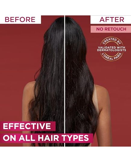 L’Oréal Paris Elvive Fall Resist Hair Serum For Weak Hair and Hair Fall 102ML