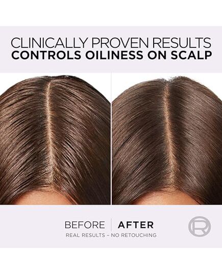 L’Oréal Paris Elvive Hyaluron Pure Rehydrating Conditioner for Oily Hair 200ML