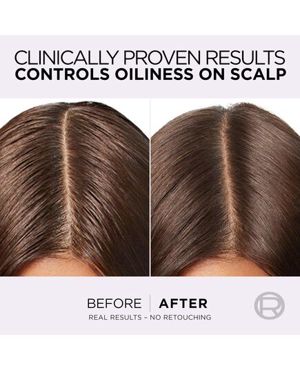 L’Oréal Paris Elvive Hyaluron Pure Rehydrating Conditioner for Oily Hair 200ML