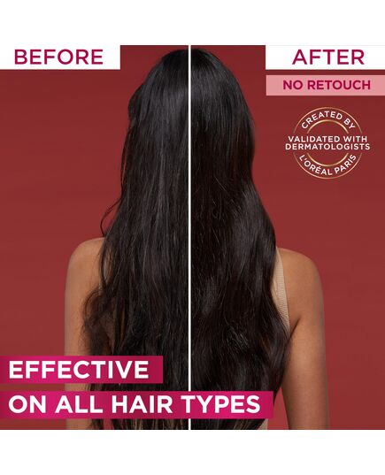 L’Oréal Paris Elvive Fall Resist Hair Serum For Weak Hair and Hair Fall 102ML