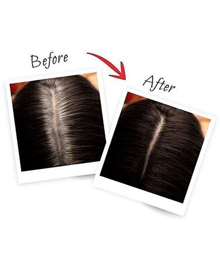 L’Oréal Paris L'Oreal Magic Retouch Instant Root Concealer, Black