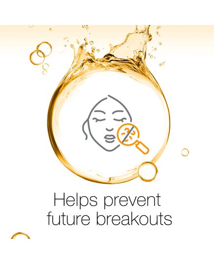 Neutrogena Spot Controlling Face Wash, Oil-free, Scientifically Proven Skin Removal Formula, For Clear & Smooth Skin, 200ml