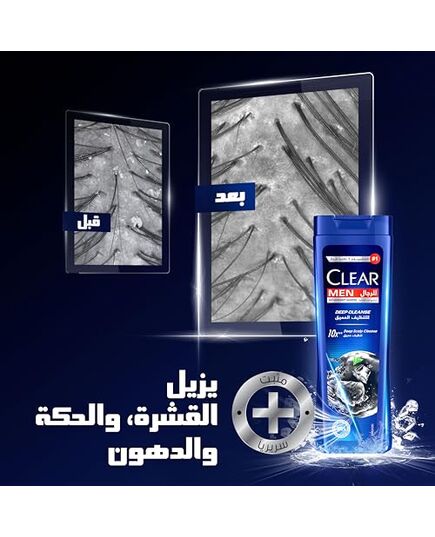 CLEAR Men Anti-dandruff Shampoo Deep Cleanse, 10x Deep Scalp Cleansing with Ultra Performance Formula, 180ML