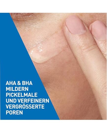 CeraVe Resurfacing Retinol Serum with Ceramides & Niacinamide for Blemish-Prone Skin 30ml