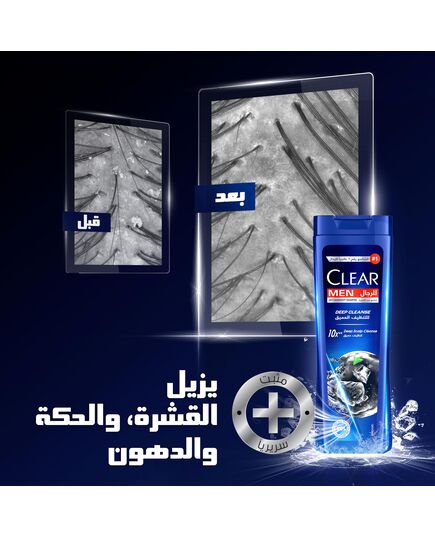 CLEAR Men Anti-dandruff Shampoo Deep Cleanse, 10x Deep Scalp Cleansing with Ultra Performance Formula, 180ML