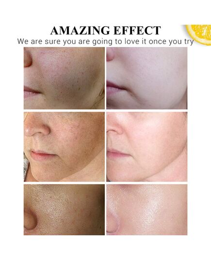 Disaar vitamin c face serum 30 ml, DS51992